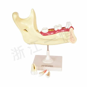 Biological Model Series兒童牙列模型